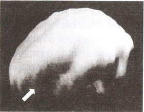 Префронтальная кора, дорсально-латеральная  префронтальная область (трехмерное изображение поверхности, вид сбоку).